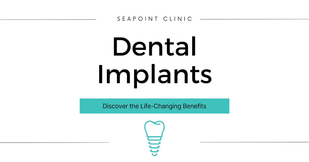 Discover the Life-Changing Benefits of Dental Implants