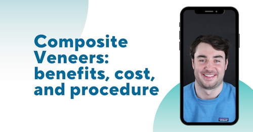Composite Veneers: Benefits, Cost, and Procedure