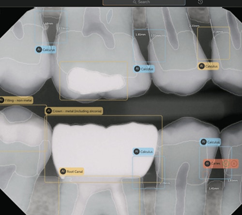 The Truth About Dental Amalgam
