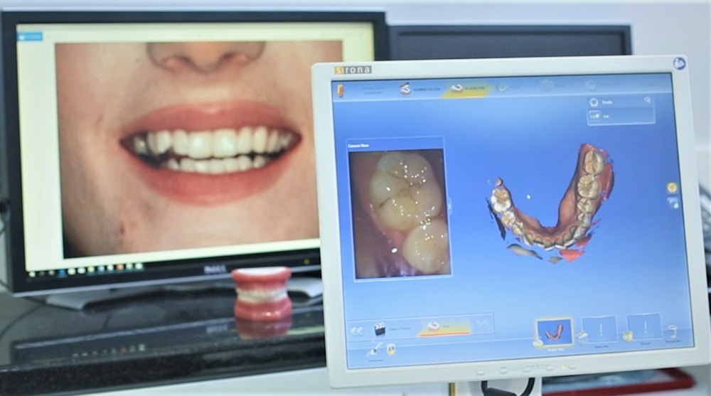 itero scan, seapoint clinic patient, orthodontist, orthodontics, braces, orthodontist dublin, teen braces, teen orthodontics, invisalign, clear braces