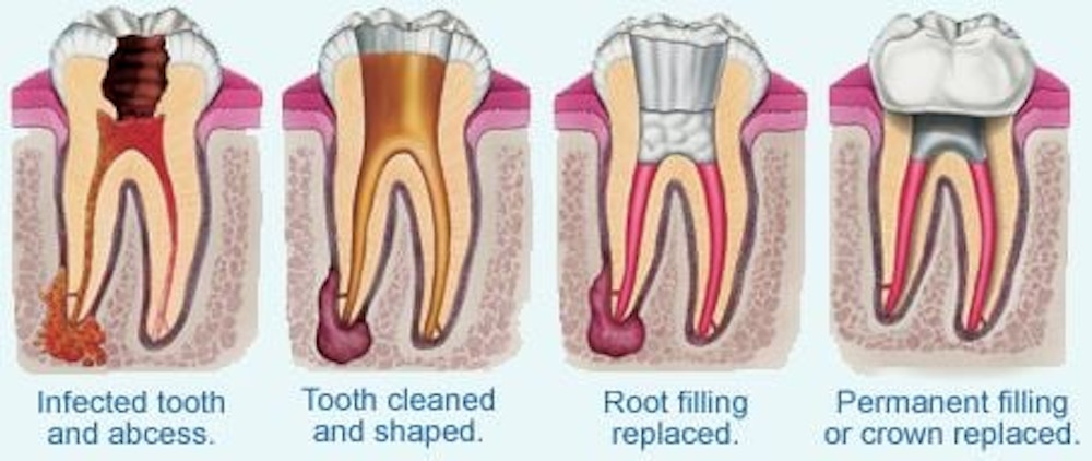 Dental clinic, dental implants, root canals, dental implants cost, recommended dentist, dublin dentist